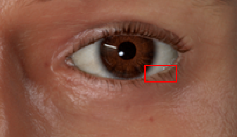 Eyelid.png